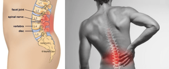 back pain hotspot
