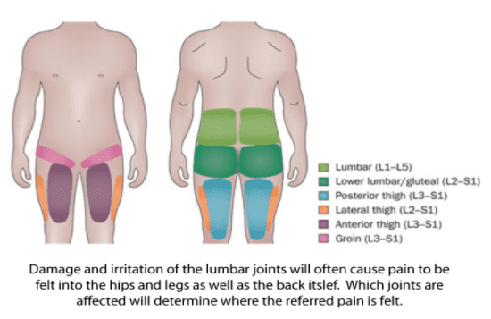 lumbar joint irritation