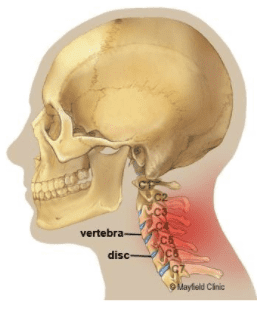 skeleton neck pain